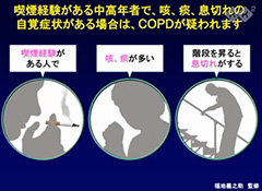 COPD どんな病気？予防と治療法は