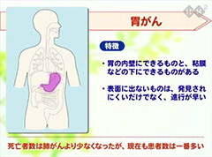 やさしいがんの知識