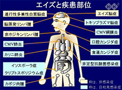 やさしいエイズの知識